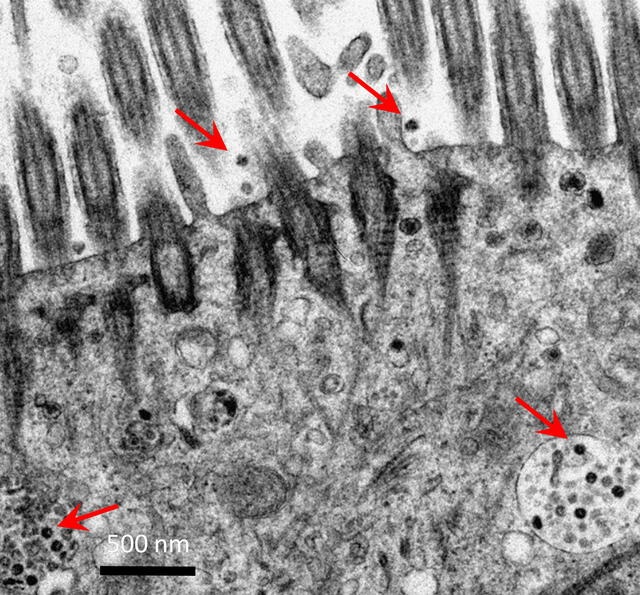 Micrografía electrónica de los tejidos de los bronquios humanos después de la infección por SARS-CoV-2. Las flechas rojas que muestran partículas virales. Foto: University of Hong Kong