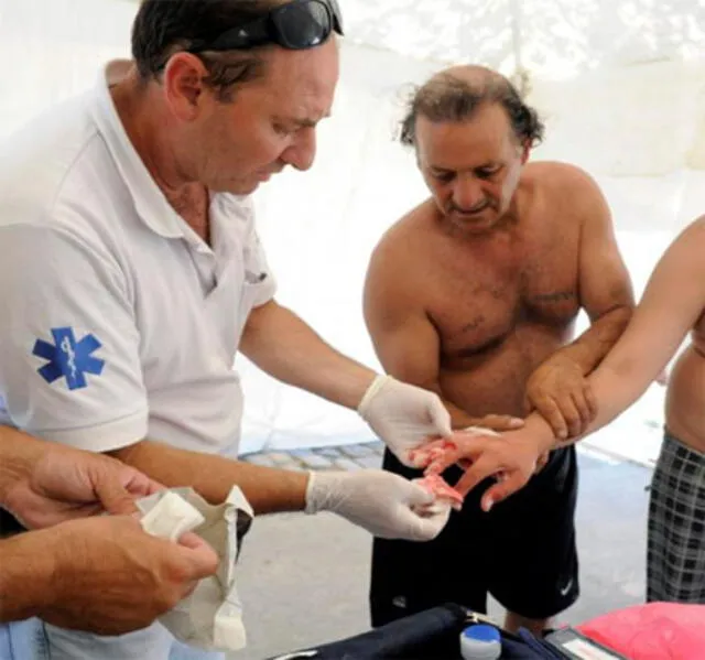La palometa provoca heridas en la manos y pies. La palometa provoca heridas en la manos y pies.
