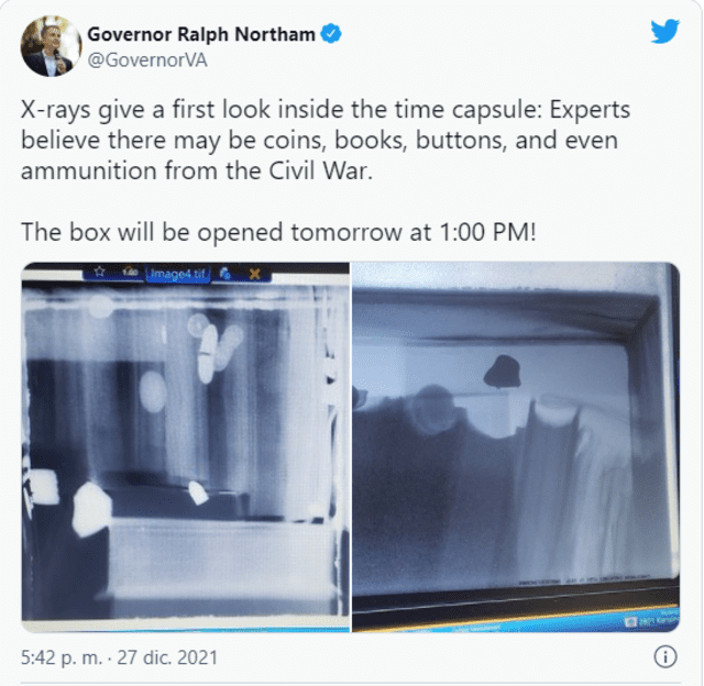 El gobernador Ralph Northam publicó las imágenes de los rayos X vía twitter. Foto: Twitter