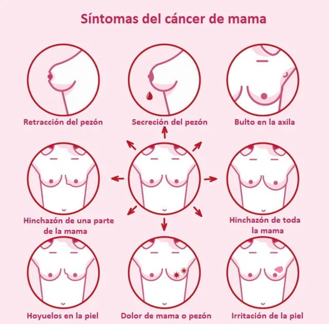  Es importante prestar atención a las señales de alerta de cáncer de mama. Foto: tucanaldesalud.es   