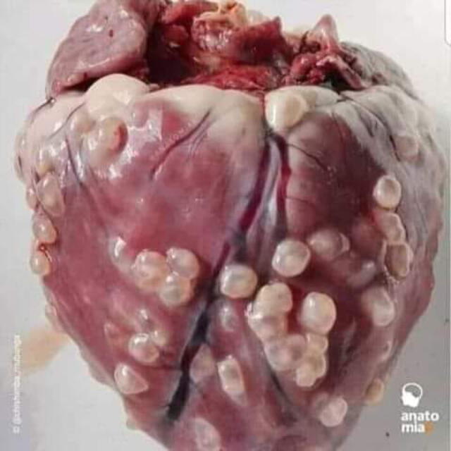 La imagen corresponde a un corazón infectado por el parásito T solium.