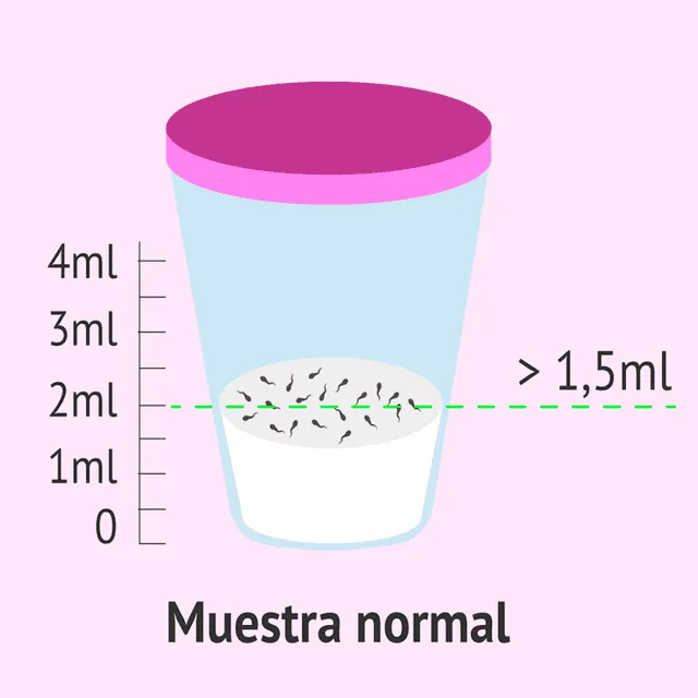 Volumen normal de semen liberado durante una eyaculación