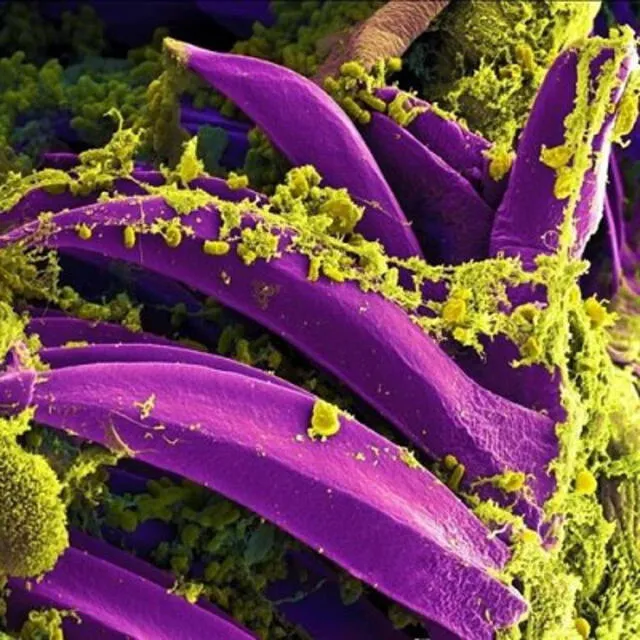 La bacteria 'Yersinia pestis' es el agente infeccioso responsable de la enfermedad peste bubónica. Foto: NIAID (Europa Press)