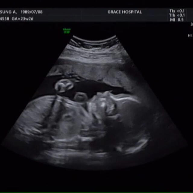 9MUSES:  Sungah compartió en Instagram una foto de su ultrasonido. 1 de enero 2020.