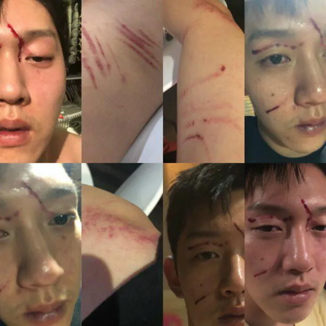 Choi Jong Bum demandó a Goo Hara por agredirlo y difundió las imágenes en redes sociales.