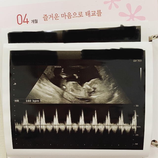 El 23 de diciembre del 2019, Eujin, ex APRIL, compartió esta imagen de su ultrasonido confirmando así que estaba embarazada.