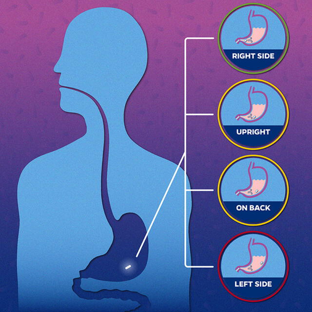 Efectos de las diferentes posturas en la absorción de la píldora. De arriba a abajo: derecha, erguido, echado boca arriba e izquierda. Imagen: Johns Hopkins
