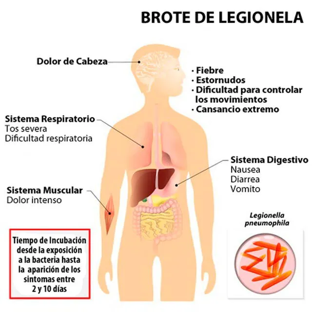 Legionella