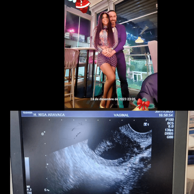  Giannina tenía previsto dar a luz en julio, aproximadamente. Foto: Instagram/Giannina Luján   