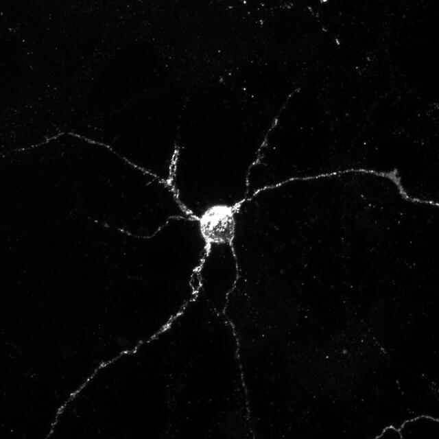  Neurona que expresa Aplp1 (en blanco), que permite que las células cerebrales absorban proteínas asociadas con la enfermedad de Parkinson.   