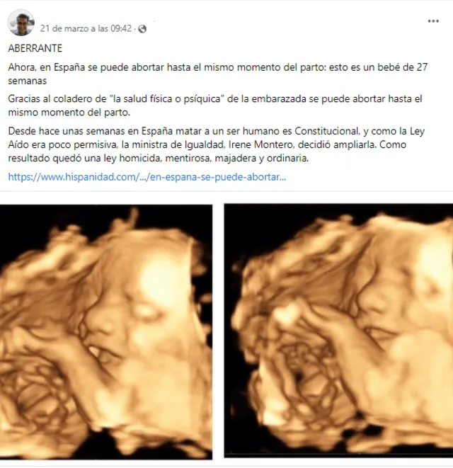 Publicación viral sobre supuesta modificación en la ley del aborto en España que amplió el periodo permitido para abortar hasta el momento del parto. Foto: captura LR/Facebook Publicación viral sobre supuesta modificación en la ley del aborto en España que amplió el periodo permitido para abortar hasta el momento del parto. Foto: captura LR/Facebook