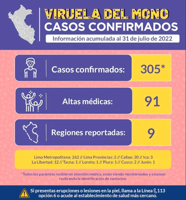Casos de viruela del mono se incrementan a 305 en el Perú. Foto: Minsa/Twitter