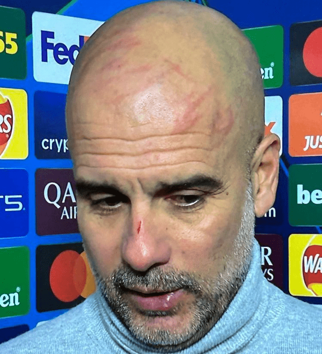 Pep Guardiola mostró un rostro lleno de heridas Foto: captura de ESPN   