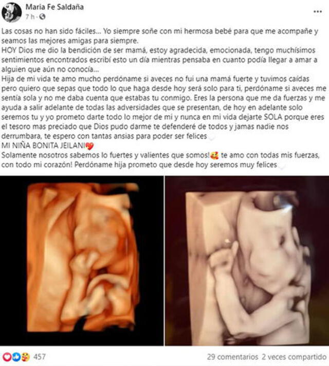 María Fe Saldaña confirma embarazo. Foto: Maria Fe Saldaña/ Facebook