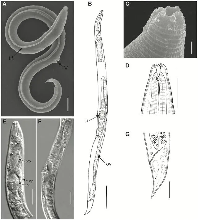 Imágenes compartidas por el grupo de científicos que muestran la morfología del nematodo congelado. Foto: Shatilovich A. et al   