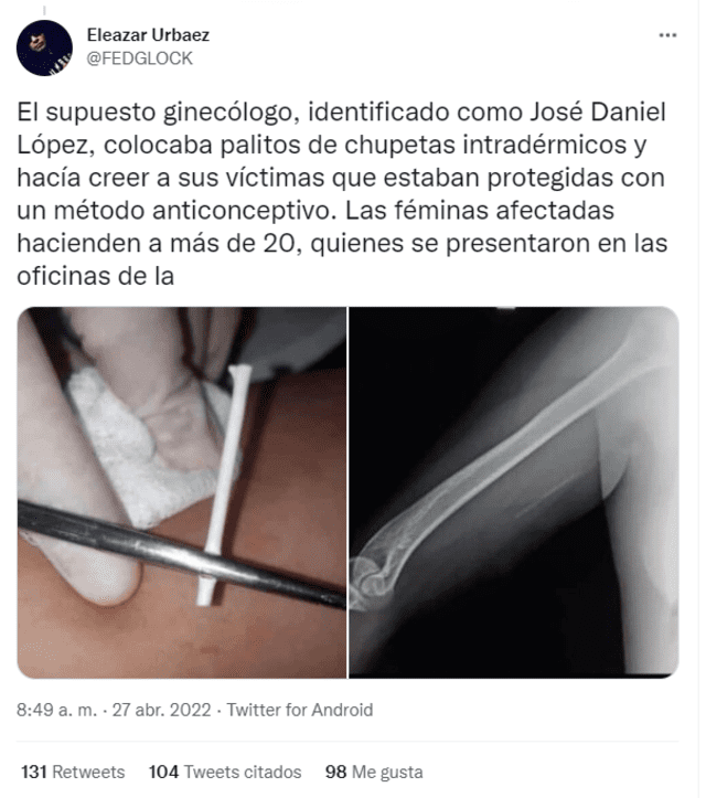 Más de 20 mujeres fueron víctimas del falso ginecólogo en La Victoria, Venezuela. Foto: captura Twitter/Eleazar Urbaez