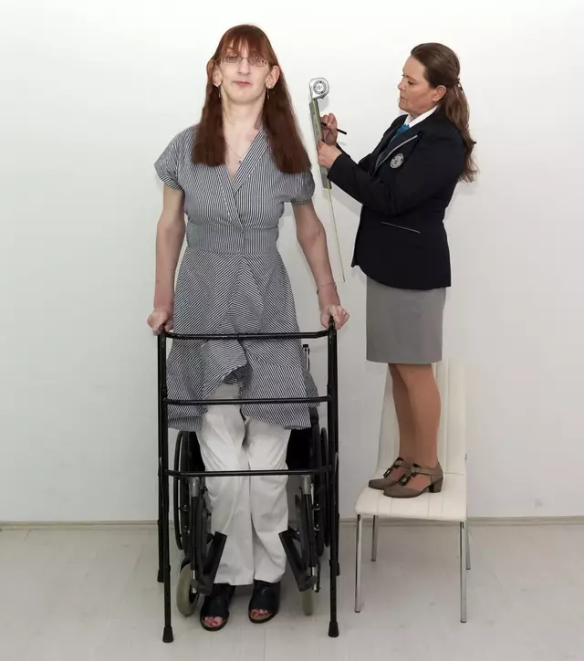 ¿Cuánto mide Rumeysa Gelgi, la mujer más alta del mundo?