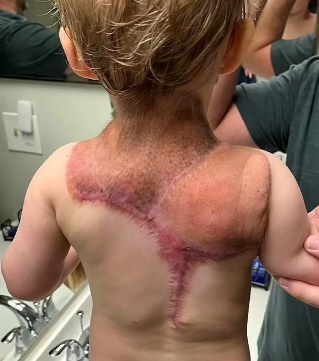 Después de exámenes y cirugías, el pequeño mejoró. Foto: Daily Mail Después de exámenes y cirugías, el pequeño mejoró. Foto: Daily Mail