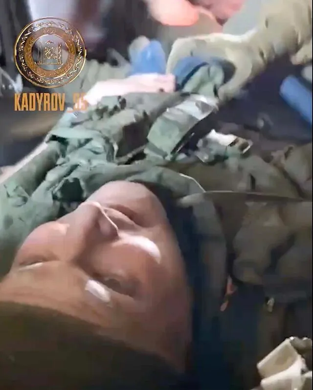 Las piernas del coronel herido Yury Medvedev fueron atropelladas por el tanque conducido por uno de sus propios soldados. Foto: East2west