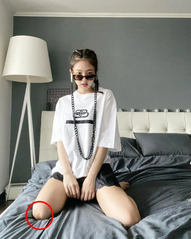 BLACKPINK: Jennie Kim presenta una lesión en la rodilla. Instagram. 1 de mayo, 2020.