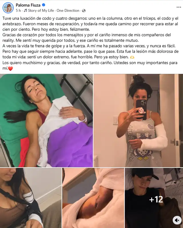 Paloma Fiuza compartió fotos de su proceso de recuperación tras sufrir lesión en 'El internado'. Foto: captura Facebook/Paloma Fiuza Paloma Fiuza compartió fotos de su proceso de recuperación tras sufrir lesión en 'El internado'. Foto: captura Facebook/Paloma Fiuza