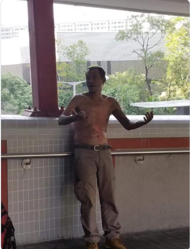 Foto publicada por un usuario de Twitter que asevera que el hombre se encuentra ileso.