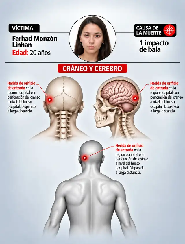 Farhad Monzón - 1 impacto de bala