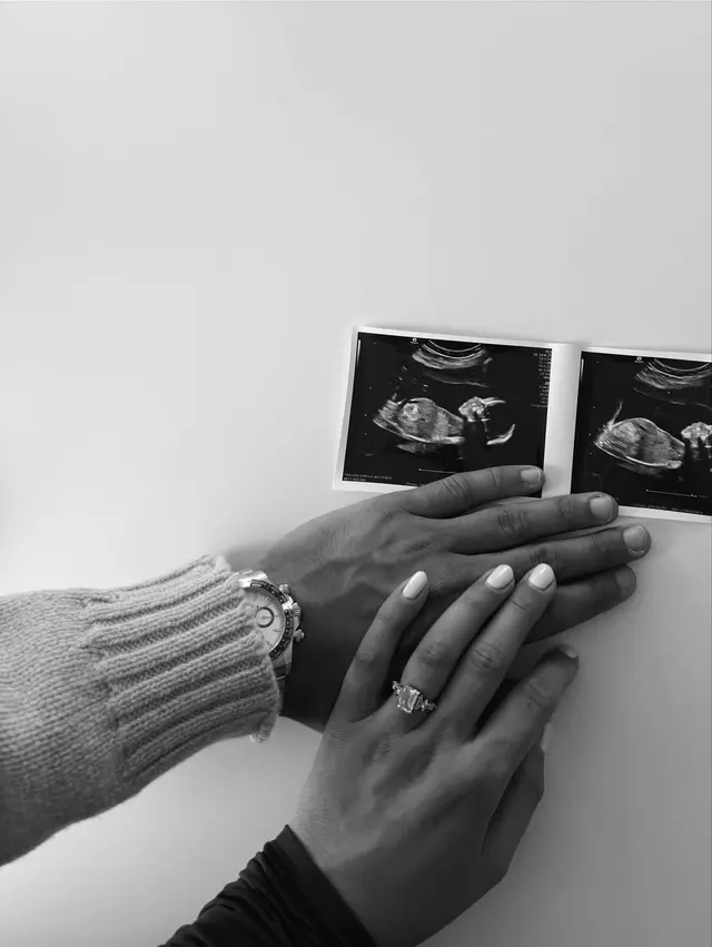  Oliver Sonne y su novia anuncian embarazo. Foto: Instagram   