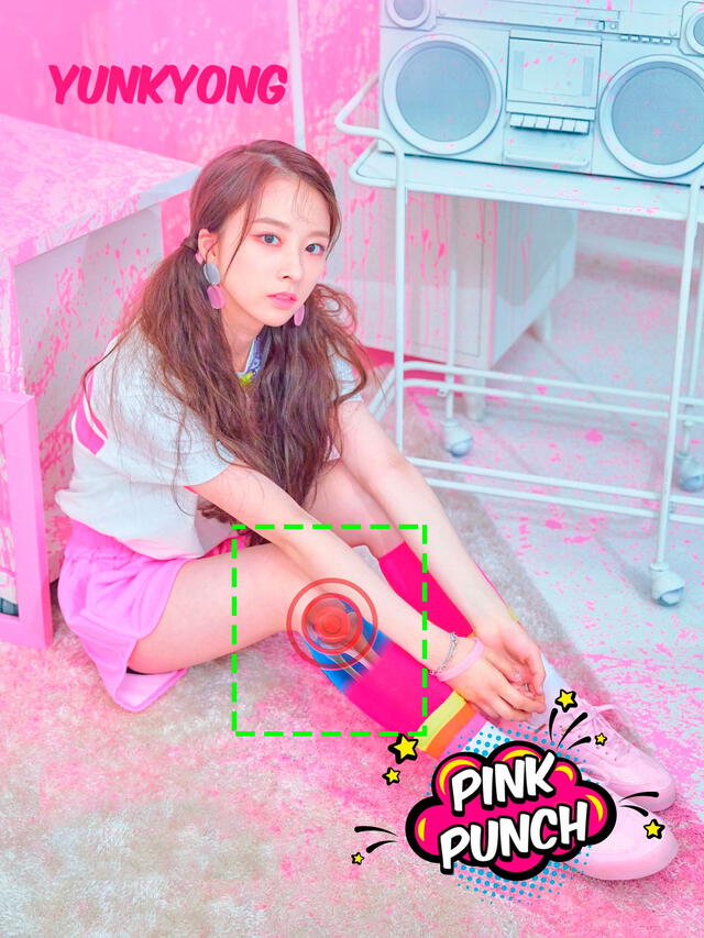 Rocket Punch: Yunkyoung tendría inflamada la membrana que recubre la articulación de su rodilla.