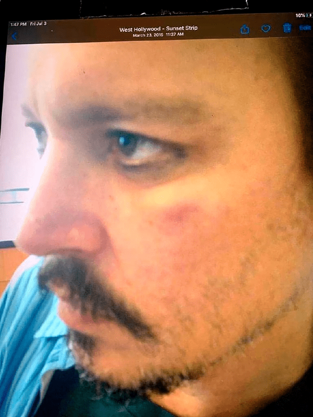 Johnny Depp con herida en el rostro: Foto: Captura Instagram.