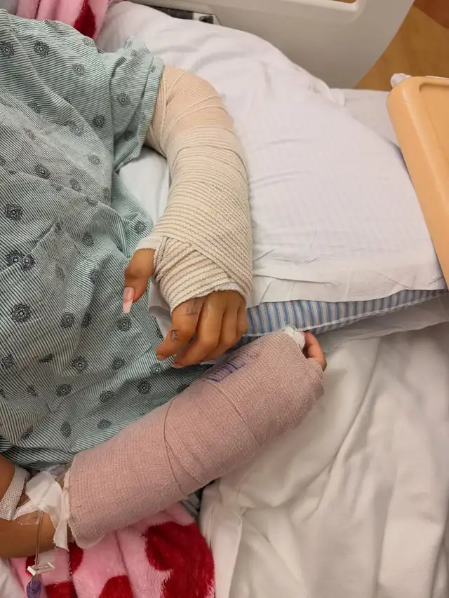 Luciana Martín fue operada del brazo izquiero Luciana Martín fue operada del brazo izquiero
