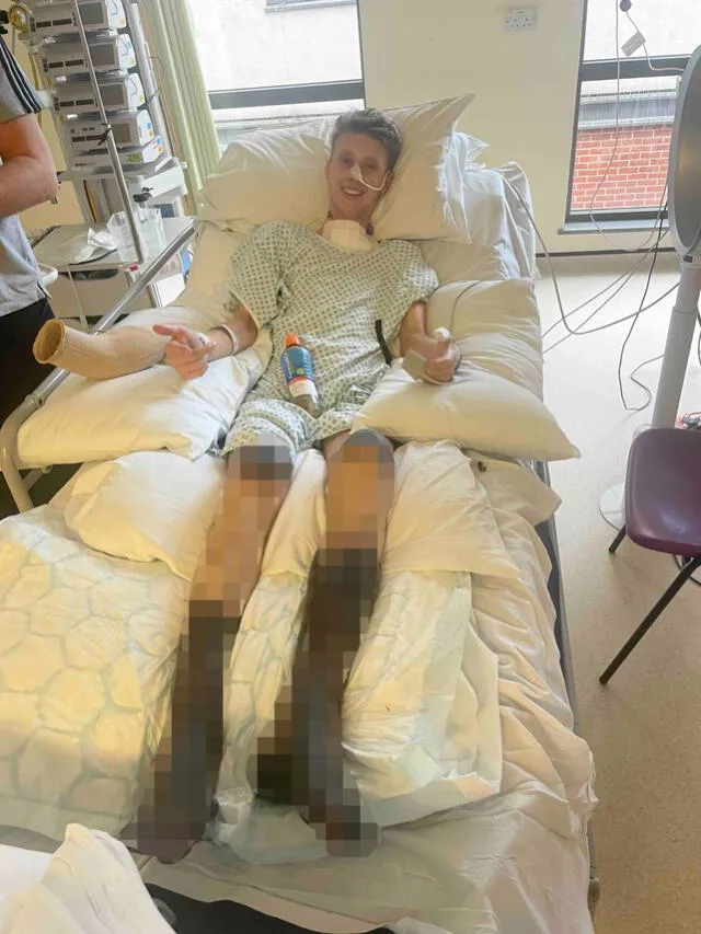  El joven perdió sus dos piernas debido a un shock séptico. Foto: GoFundMe   