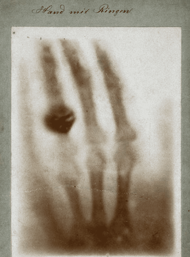 Primera foto de una radiografia