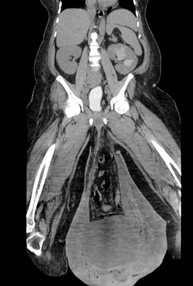 La tomografía difundida por los especialistas. Foto: Urology Case Reports.