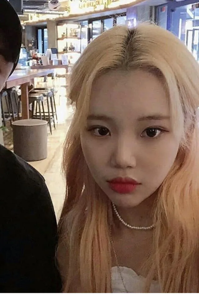 MOMOLAND: JooE tras su supuesta cirugía del doble párpado o blefaroplastia.