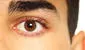 ¿Por qué late mi ojo y cuán peligroso es para mi salud?