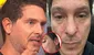 Cristian Rivero revela extraña reacción en su rostro que afecta su salud: “Los nervios existen”