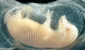 Científicos de China crean corazones con células humanas en embriones de cerdo: un avance clave para los futuros trasplantes
