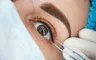 ¿Qué es la queratopigmentación? La peligrosa operación cosmética podría dejarte sin visión