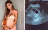 ¡Paula Manzanal está embarazada! Modelo anuncia que espera segundo hijo